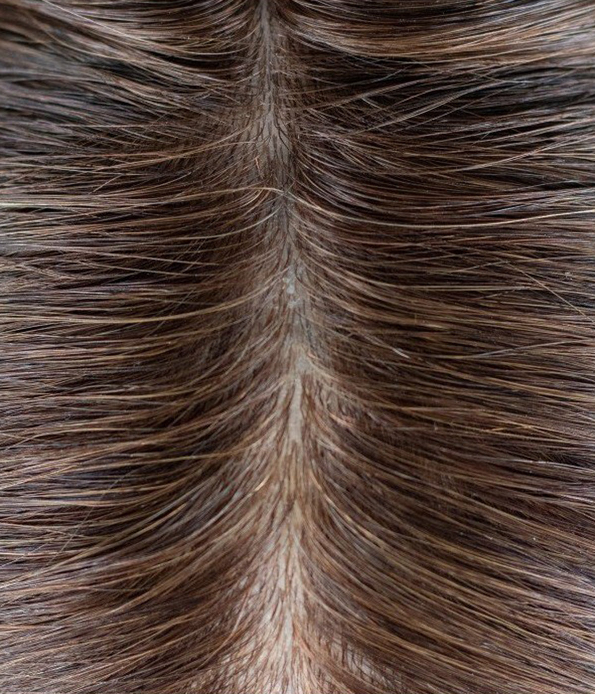 Human Hair Topper - Full Skin Base Women's System 7x9 - close-up of brown injected-hair part