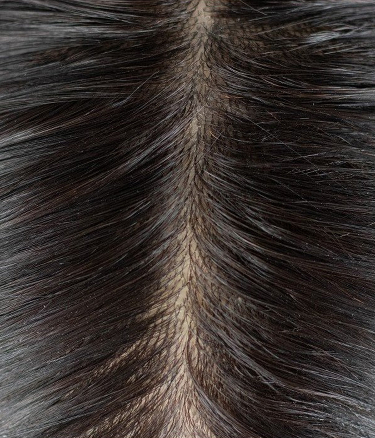 Human Hair Topper - Full Skin Base Women's System 7x9 - close-up of dark injected-hair part